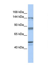 CSE1L antibody LS-C112268 Western blot of Fetal Brain lysate. Antibody concentration 1 ug/ml.