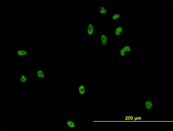 Immunofluorescence of monoclonal antibody to CSE1L on HeLa cell (antibody concentration 10 ug/ml).