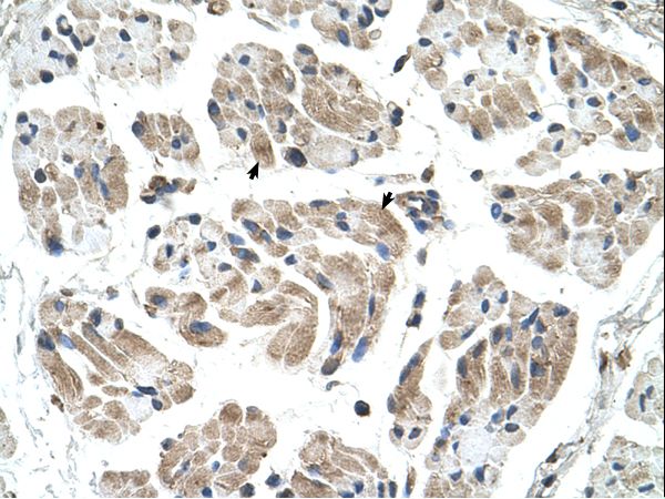 CHST1 antibody LS-C80727 was used in IHC to stain formalin-fixed, paraffin-embedded human muscle.