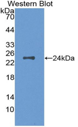 Western blot of recombinant CSF1 / MCSF.