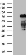 HEK293T cells were transfected with the pCMV6-ENTRY control (Left lane) or pCMV6-ENTRY CSF1 (Right lane) cDNA for 48 hrs and lysed. Equivalent amounts of cell lysates (5 ug per lane) were separated by SDS-PAGE and immunoblotted with anti-CSF1.