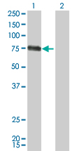 Western Blot analysis of CSF1 expression in transfected 293T cell line by CSF1 monoclonal antibody (M01), clone 1A9.Lane 1: CSF1 transfected lysate(60.1 KDa).Lane 2: Non-transfected lysate.