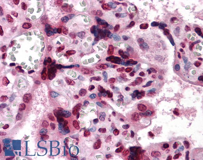 Anti-CSF1 / MCSF antibody IHC of human placenta. Immunohistochemistry of formalin-fixed, paraffin-embedded tissue after heat-induced antigen retrieval. Antibody LS-B4135 dilution 1:200.