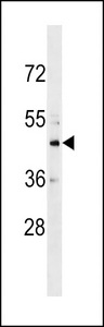 CHST10 Antibody western blot of HL-60 cell line lysates (35 ug/lane). The CHST10 antibody detected the CHST10 protein (arrow).