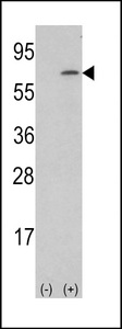 Western blot of lysate from human placenta tissue lysate, using M-CSF Antibody. Antibody was diluted at 1:1000 at each lane. A goat anti-rabbit IgG H&L (HRP) at 1:5000 dilution was used as the secondary antibody. Lysate at 35ug per lane.