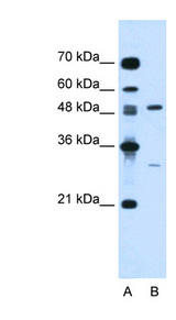 CSF1 / MCSF antibody LS-C40471 Western blot of Jurkat lysate.