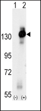 Western blot of CSF1R (arrow) using rabbit polyclonal CSF1R Antibody. 293 cell lysates (2 ug/lane) either nontransfected (Lane 1) or transiently transfected with the CSF1R gene (Lane 2) (Origene Technologies).