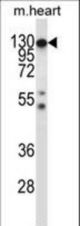 Mouse Csf1r Antibody western blot of mouse heart tissue lysates (35 ug/lane). The Csf1r antibody detected the Csf1r protein (arrow).