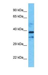 Western blot of CHST10 Antibody with Jurkat Whole Cell lysate.