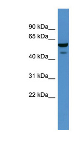 CHST11 antibody LS-C135204 Western blot of Rat Kidney lysate.