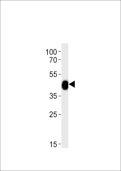 DANREchst11 Antibody western blot of zebra fish heart tissue lysates (35 ug/lane). The DANREchst11 antibody detected the DANREchst11 protein (arrow).