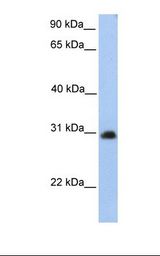 HepG2 cell lysate. Antibody concentration: 1.0 ug/ml. Gel concentration: 12%.