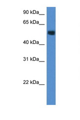 CHST2 antibody LS-C145213 Western blot of Mouse Brain lysate. Antibody concentration 1 ug/ml.