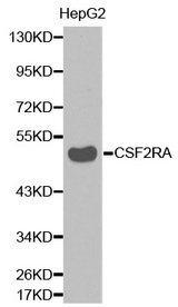 Western blot analysis of extracts of HepG2 cell lines, using CSF2RA antibody.