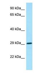 CSF2RA / CD116 antibody Western Blot of Fetal Heart.