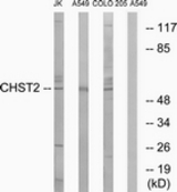 Western blot of extracts from A549/COLO/Jurkat cells, using CHST2 Antibody. The lane on the right is treated with the synthesized peptide.