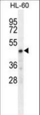 CHST2 Antibody western blot of HL-60 cell line lysates (35 ug/lane). The CHST2 antibody detected the CHST2 protein (arrow).