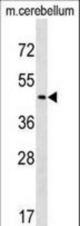 CHST2 Antibody western blot of mouse cerebellum tissue lysates (35 ug/lane). The CHST2 antibody detected the CHST2 protein (arrow).