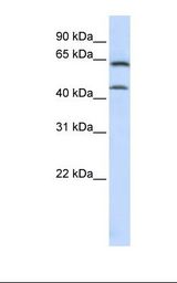 MCF7 cell lysate. Antibody concentration: 1.0 ug/ml. Gel concentration: 12%.