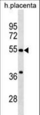 CHST2 Antibody western blot of human placenta tissue lysates (35 ug/lane). The CHST2 antibody detected the CHST2 protein (arrow).
