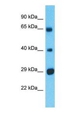 Western blot of CSGALNACT2 Antibody with human Thymus Tumor lysate.