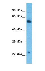 Western blot of CGAT2 Antibody with human HepG2 Whole Cell lysate.