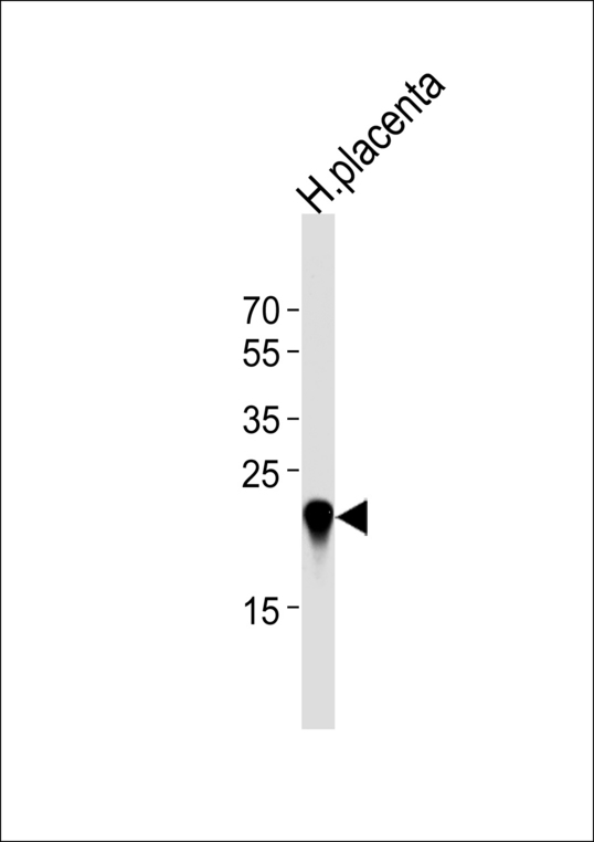 Western blot of lysate from human placenta tissue lysate, using CSHL1 Antibody. Antibody was diluted at 1:1000 at each lane. A goat anti-rabbit IgG H&L (HRP) at 1:5000 dilution was used as the secondary antibody. Lysate at 35ug per lane.