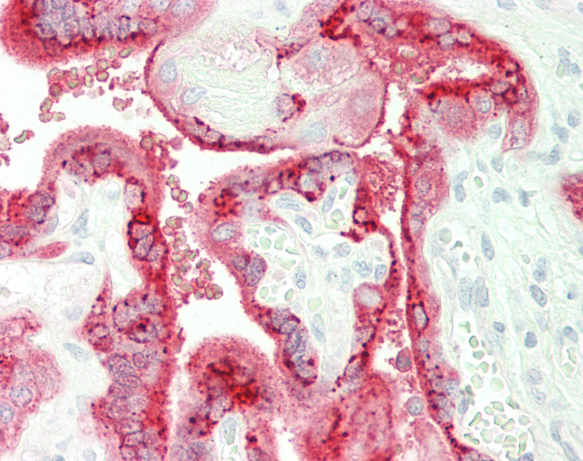 Human Placenta: Formalin-Fixed, Paraffin-Embedded (FFPE)