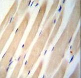 CHST3 antibody immunohistochemistry of formalin-fixed and paraffin-embedded human skeletal muscle followed by peroxidase-conjugated secondary antibody and DAB staining.