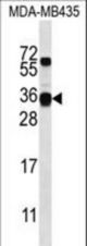 CSN2 Antibody western blot of MDA-MB435 cell line lysates (35 ug/lane). The CSN2 antibody detected the CSN2 protein (arrow).