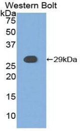 Western blot of recombinant CSNK1A1 / CK1 Alpha.