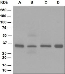 Western blot analysis on (A) MCF-7, (B) HeLa, (C) Jurkat, and (D) HT-1376 cell lysates using anti-Casein Kinase I antibody.