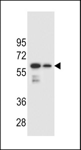 CHST3 Antibody western blot of mouse spleen and lung tissue lysates (35 ug/lane). The CHST3 antibody detected the CHST3 protein (arrow).