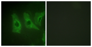 Immunofluorescence of HeLa cells, using CKI-alpha (Ab-321) Antibody. The picture on the right is treated with the synthesized peptide.