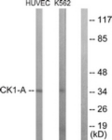 Western blot of extracts from HUVEC/K562 cells, using CKI-alpha (Ab-321) Antibody. The lane on the right is treated with the synthesized peptide.