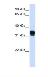 293T cell lysate. Antibody concentration: 1.0 ug/ml. Gel concentration: 12%.