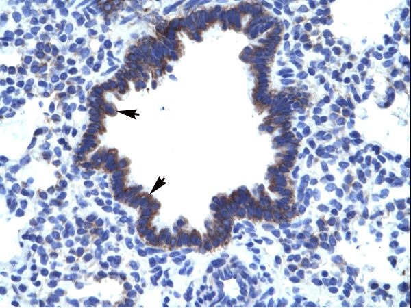 CHST4 / GST3 antibody LS-C30920 was used in IHC to stain formalin-fixed, paraffin-embedded human lung.