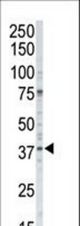 Western blot of anti-CK1a antibody in A375 cell lysate. CK1a (arrow) was detected using purified antibody. Secondary HRP-anti-rabbit was used for signal visualization with chemiluminescence.