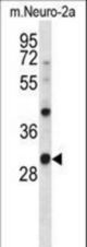 Mouse Csnk1a1 Antibody western blot of mouse Neuro-2a cell line lysates (35 ug/lane). The Csnk1a1 antibody detected the Csnk1a1 protein (arrow).