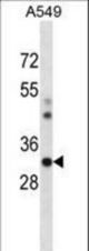Mouse Csnk1a1 Antibody western blot of A549 cell line lysates (35 ug/lane). The Csnk1a1 antibody detected the Csnk1a1 protein (arrow).