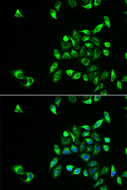 Immunofluorescence analysis of HeLa cell using CSNK1A1L antibody. Blue: DAPI for nuclear staining.