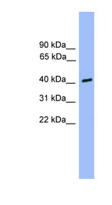 CSNK1A1L antibody LS-C116518 Western blot of 721_B cell lysate.