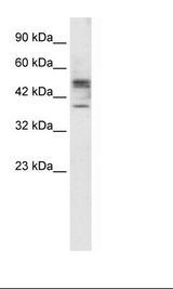 Jurkat Cell Lysate