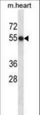 Mouse Csnk1d Antibody western blot of mouse heart tissue lysates (35 ug/lane). The Csnk1d antibody detected the Csnk1d protein (arrow).