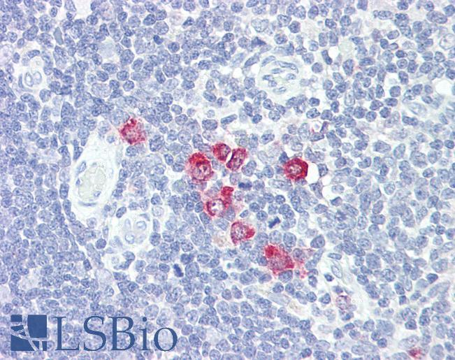 Anti-GlcNAc6ST2 / CHST4 antibody IHC of human thymus. Immunohistochemistry of formalin-fixed, paraffin-embedded tissue after heat-induced antigen retrieval. Antibody LS-B8069 dilution 5-10 ug/ml.