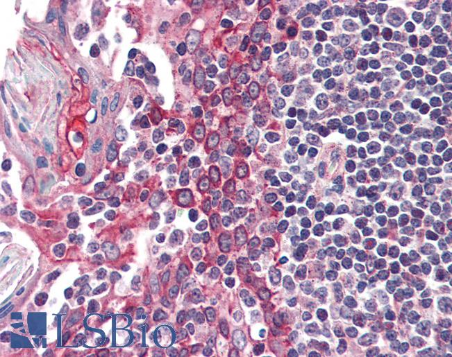Anti-CSNK1E antibody IHC of human tonsil. Immunohistochemistry of formalin-fixed, paraffin-embedded tissue after heat-induced antigen retrieval. Antibody LS-B2412 concentration 5 ug/ml.