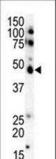 Western blot of anti-CK1e C-term antibody in SKBR3 cell lysate. CK1e (arrow) was detected using purified antibody. Secondary HRP-anti-rabbit was used for signal visualization with chemiluminescence.