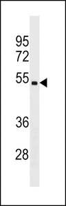 CHST5 Antibody western blot of ZR-75-1 cell line lysates (35 ug/lane). The CHST5 antibody detected the CHST5 protein (arrow).