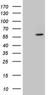 HEK293T cells were transfected with the pCMV6-ENTRY control (Left lane) or pCMV6-ENTRY CSNK1G1 (Right lane) cDNA for 48 hrs and lysed. Equivalent amounts of cell lysates (5 ug per lane) were separated by SDS-PAGE and immunoblotted with anti-CSNK1G1.