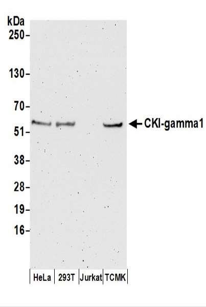 Detection of Human and Mouse CKI-gamma1 by Western Blot. Samples: Whole cell lysate (50 ug) prepared using NETN buffer from HeLa, 293T, Jurkat, and mouse TCMK-1 cells. Antibodies: Affinity purified rabbit anti-CKI-gamma1 antibody used for WB at 0.1 ug/ml. Detection: Chemiluminescence with an exposure time of 3 minutes.
